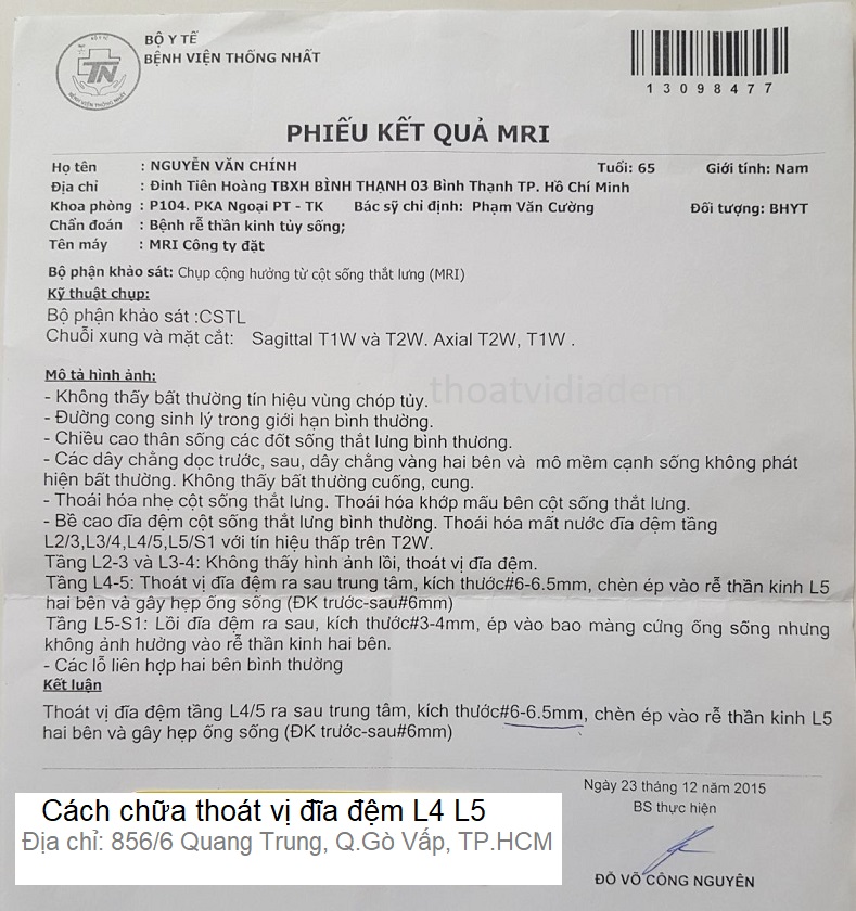 Cách chữa Thoát vị đĩa đệm L4 L5